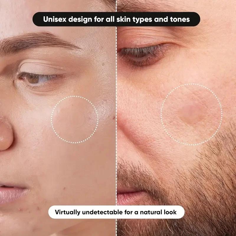 360 pieces/box acne patches -  - огляд і ціна Essential Oils